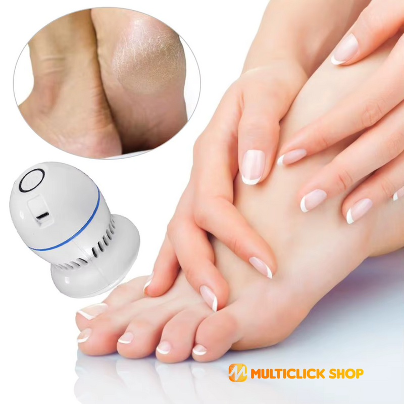 Removedor de calos e rachaduras Beauty Feet